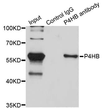 IHC-plus™ PDI / P4HB Antibody