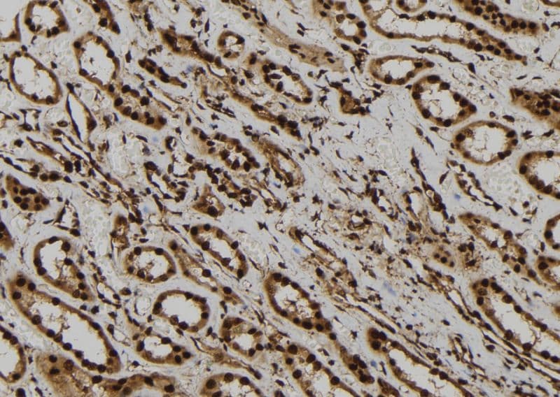 AGO1 / EIF2C Antibody