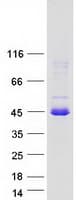 Human CCDC107 Protein (Recombinant Myc-DDK (Flag))