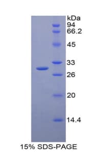 Human GSTM2 Protein (Recombinant His-T7)