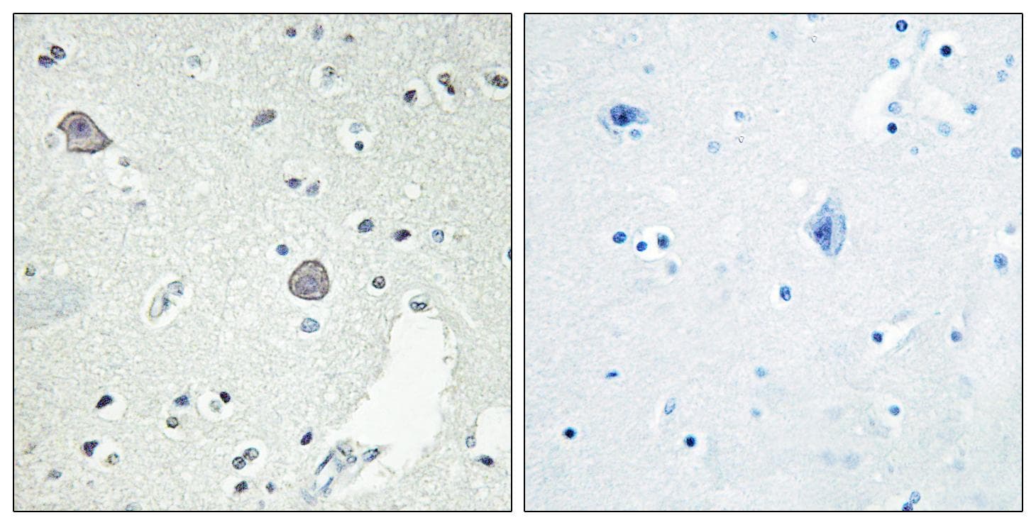 DRD1 / Dopamine Receptor D1 Antibody