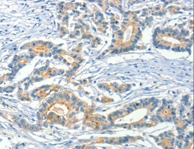 ASAH2 Antibody
