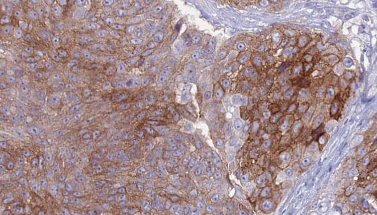 MSR1 / CD204 Antibody