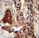CCDC122 Antibody (aa203-231)