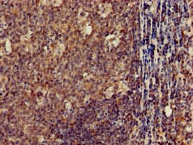 CLDN10 / Claudin 10 Antibody
