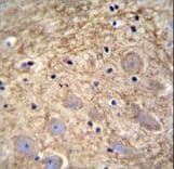 Polyclonal Rabbit anti-Human PCDHGA1 Antibody (aa287-315, IHC, WB)