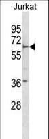 Polyclonal Rabbit anti-Human FBXW5 Antibody (aa324-350, WB)