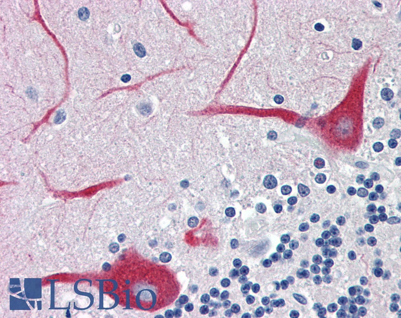 IHC-plus™ ATP2A3 / SERCA3 Antibody (clone 2H3)