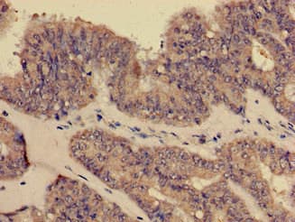 CR1 / CD35 Antibody (aa901-1095)