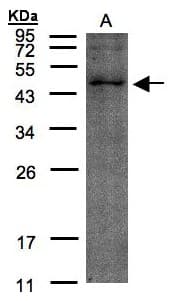 Polyclonal Rabbit anti-Human TMLHE / TMID Antibody (aa115-397, WB)