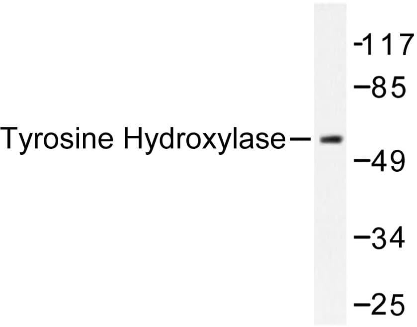 TH / Tyrosine Hydroxylase Antibody (Pro2)