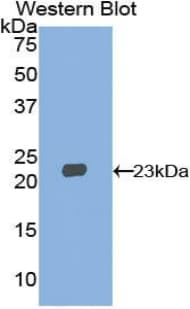 Polyclonal Rabbit anti-Human HMGCS1 / HMG-CoA Synthase 1 Antibody (aa293-467, WB)