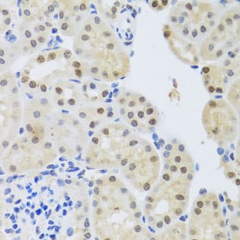 Polyclonal Rabbit anti-Human SET / TAF-I Antibody (IHC, WB)