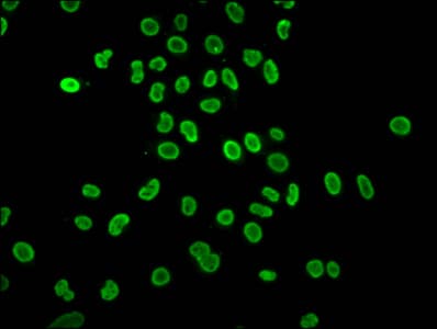 HIST1H4I Antibody