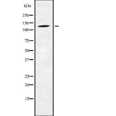 PHKB Antibody