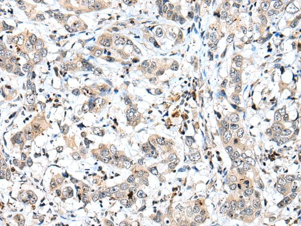 SPCS2 Antibody