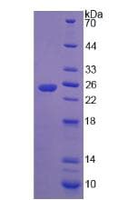 Human IFNE / Interferon Epsilon Protein (Recombinant His)