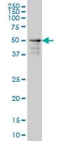 Monoclonal Mouse anti-Human ZNF213 Antibody (clone 5D7, IHC, WB)