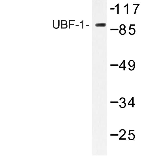 Polyclonal Rabbit anti-Human UBTF / UBF Antibody (Glu536, IHC, WB)