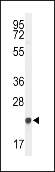 IHC-plus™ Polyclonal Rabbit anti-Human GGCT Antibody (aa139-168, IHC, WB)