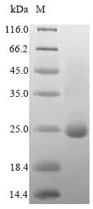 Human DOCK8 Protein (Recombinant 6His, N-terminus)