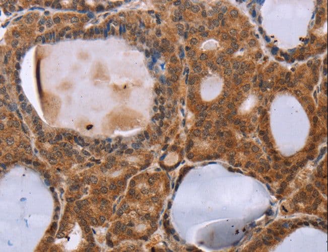 Polyclonal Rabbit anti-Human NDUFA2 Antibody (IHC, WB)
