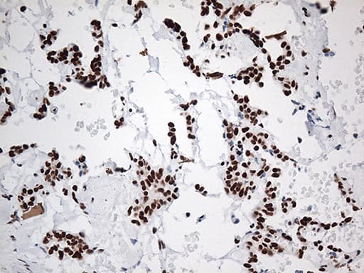 Monoclonal Mouse anti-Human EWSR1 / EWS Antibody (clone OTI3F6, aa256-447, IHC, IF, WB)