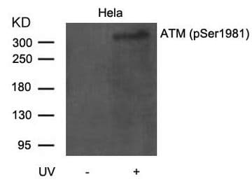 Polyclonal Rabbit anti-Human ATM Antibody (phospho-Ser1981, IHC, WB)
