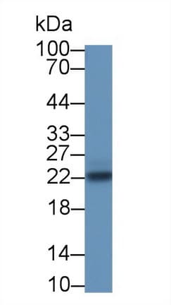 SOCS2 Antibody (aa1-198, Biotin)