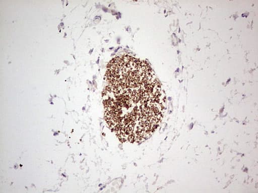 Monoclonal Mouse anti-Human NEFM / NF-M Antibody (clone OTI5B7, aa413-773, IHC, WB)