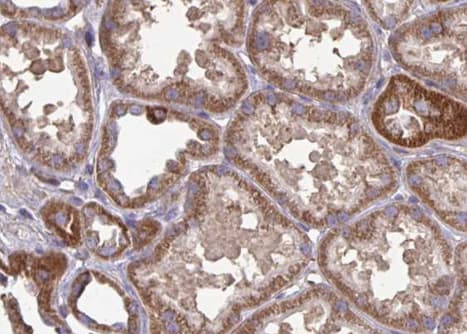 FAP Alpha Antibody