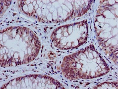 HIST1H3A Antibody