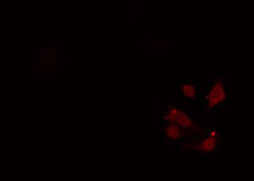 Band 4.1 / EPB41 Antibody