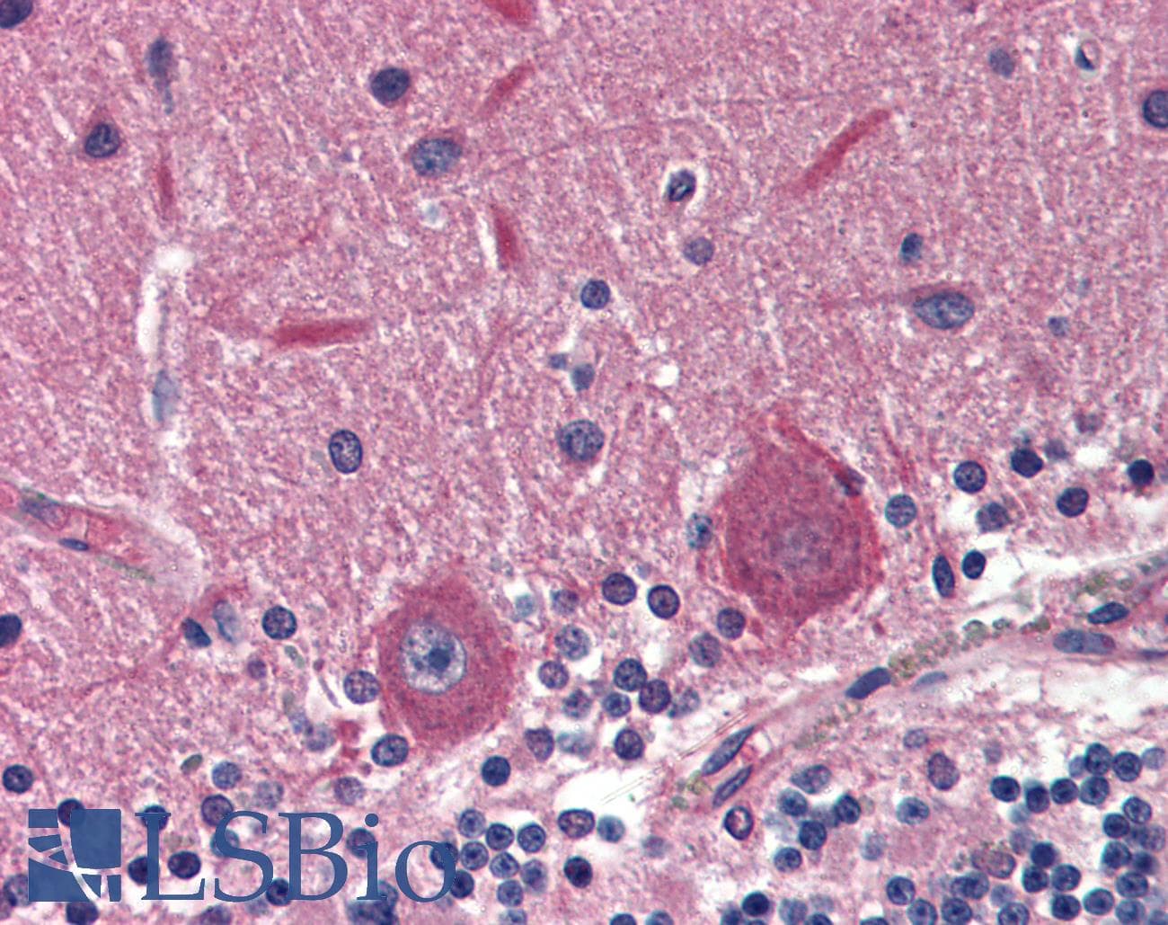 IHC-plus™ EXOC4 / SEC8 Antibody (clone 14G1)