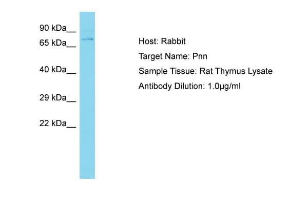 Polyclonal Rabbit anti-Rat PNN / Pinin Antibody (aa80-129, WB)