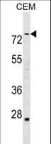 ABLIM3 Antibody (aa613-641)