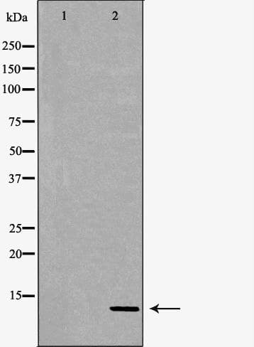 S100A4 / FSP1 Antibody
