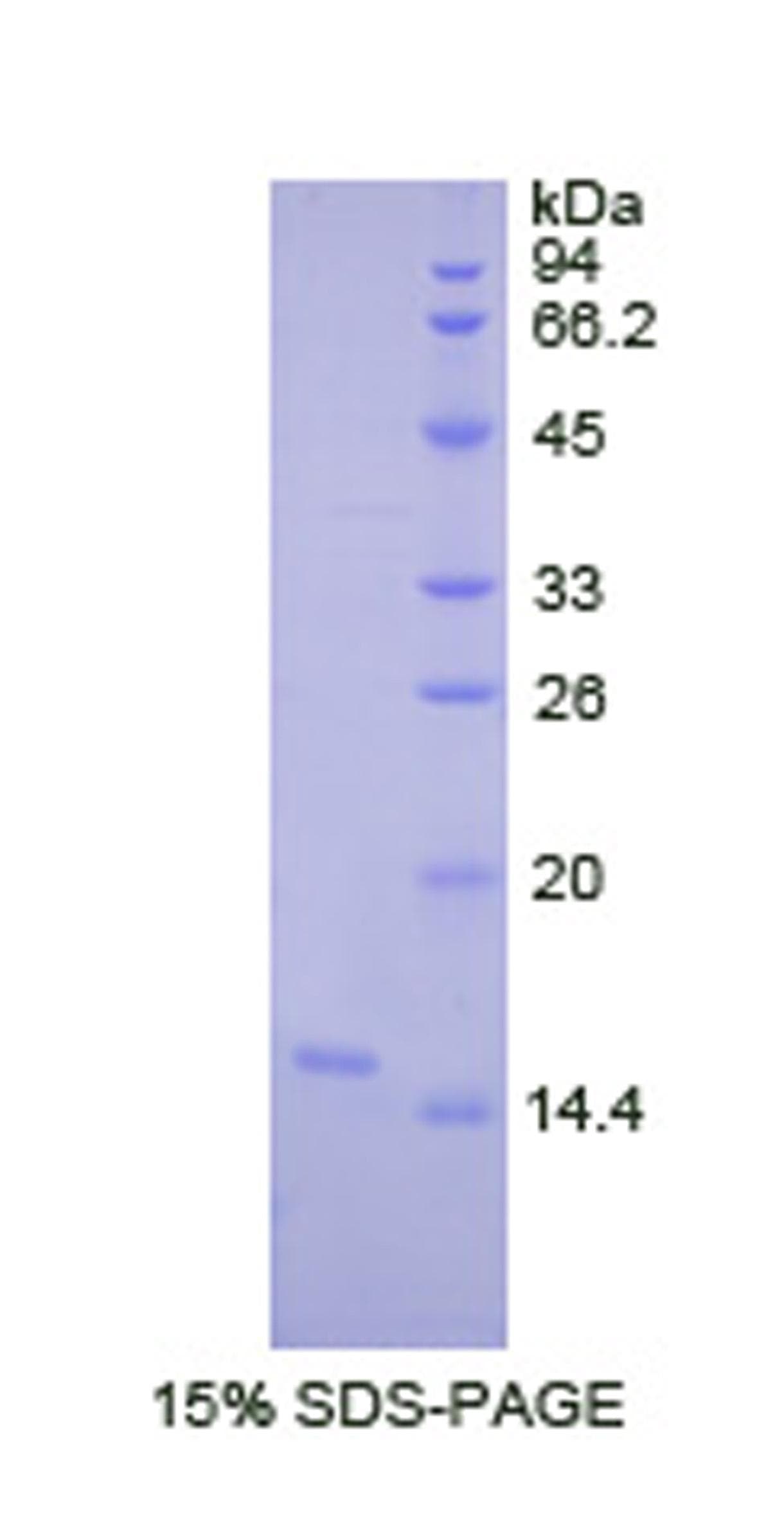 Human LOXL2 Protein (Recombinant His, N-Terminal)