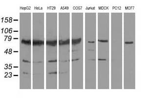 PUS7 Antibody (clone OTI4H5)