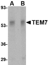 IHC-plus™ Polyclonal Rabbit anti-Human TEM7 Antibody (IHC, IF, WB)