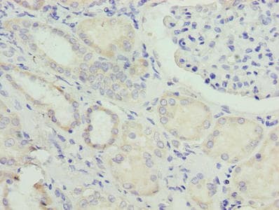 NUPL2 Antibody