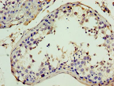 ITIH4 Antibody (aa689-930)