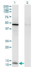 CCL2 / MCP1 Antibody (clone 1F10)