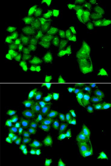 FBXO7 Antibody