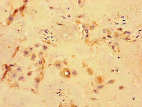 Polyclonal Rabbit anti-Human PKD1L3 Antibody (IHC, IF)