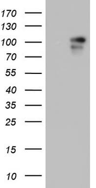 BFSP1 / Filensin Antibody (aa405-665, clone OTI3H1)