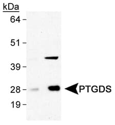 Polyclonal Rabbit anti-Human Prostaglandin D Synthase Antibody (Biotin, aa120-190, IHC, WB)