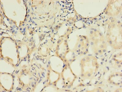 ALK3 / BMPR1A Antibody (aa177-532)