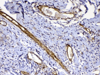 FLT4 / VEGFR3 Antibody
