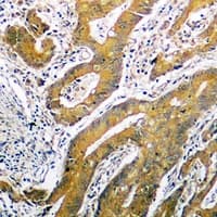 TP53 / p53 Antibody (C-Terminus)